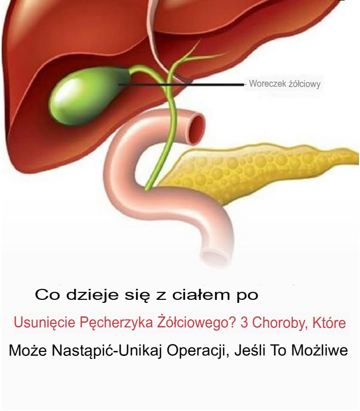 Co dzieje się z ciałem po usunięciu pęcherzyka żółciowego?