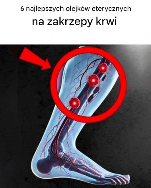6 najlepszych olejków do naturalnego rozpuszczania skrzepów krwi