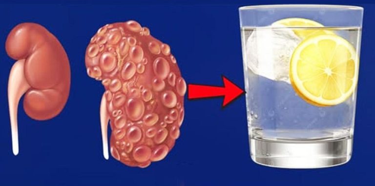6 naturalnych napojów poprawiających zdrowie nerek i ogólne samopoczucie