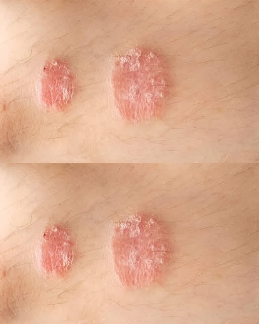 Ostrzegawcze znaki, których nigdy nie należy ignorować w przypadku skóry