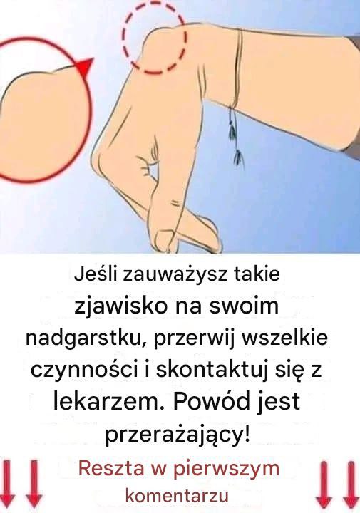 Guzek na nadgarstku: Kiedy należy się martwić i jak zadbać o zdrowie dłoni?