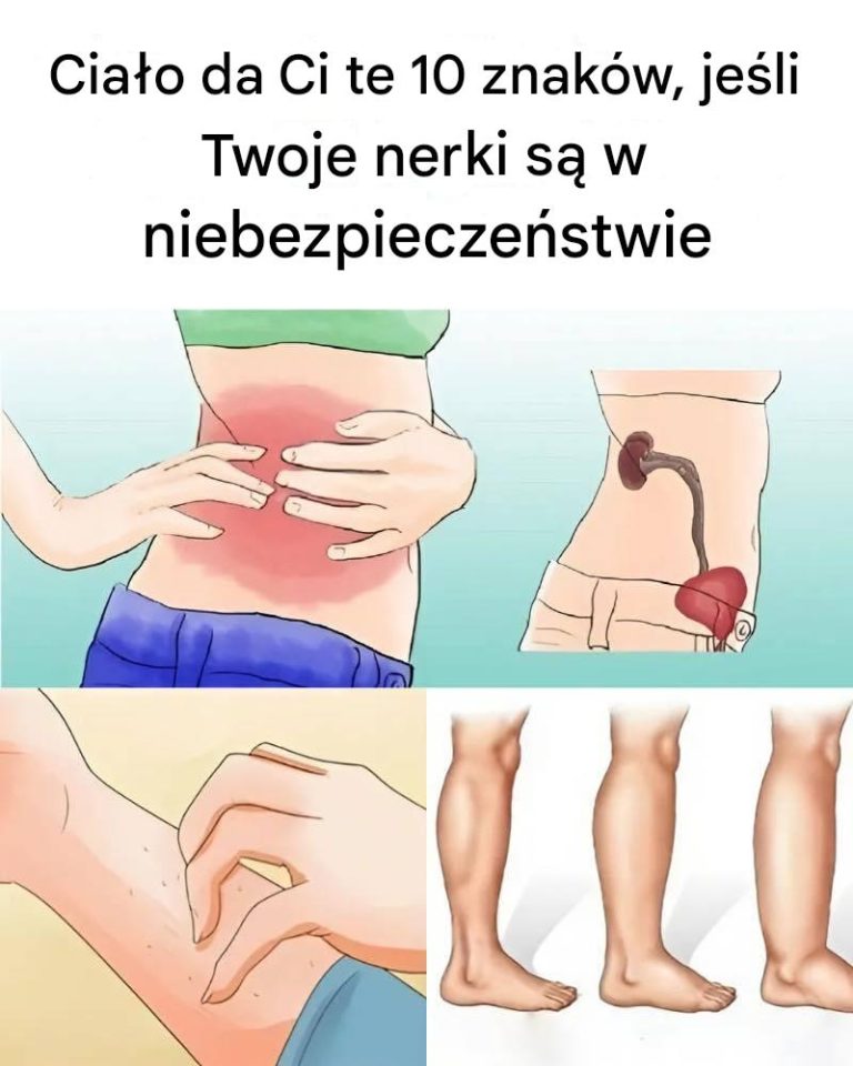 „Zdrowie nerek na talerzu: przepis na rozpoznanie 10 niepokojących objawów”