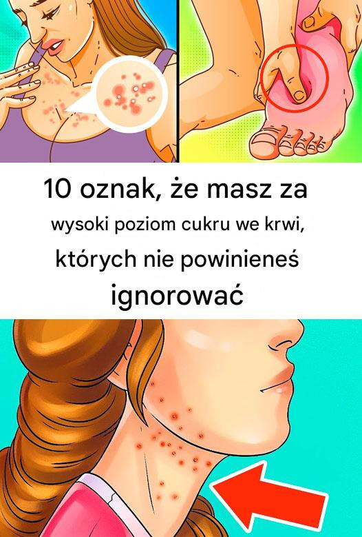 Cukrowy Alarm: 10 Sygnałów, Że Twoje Ciało Woła o Detoks od Słodyczy