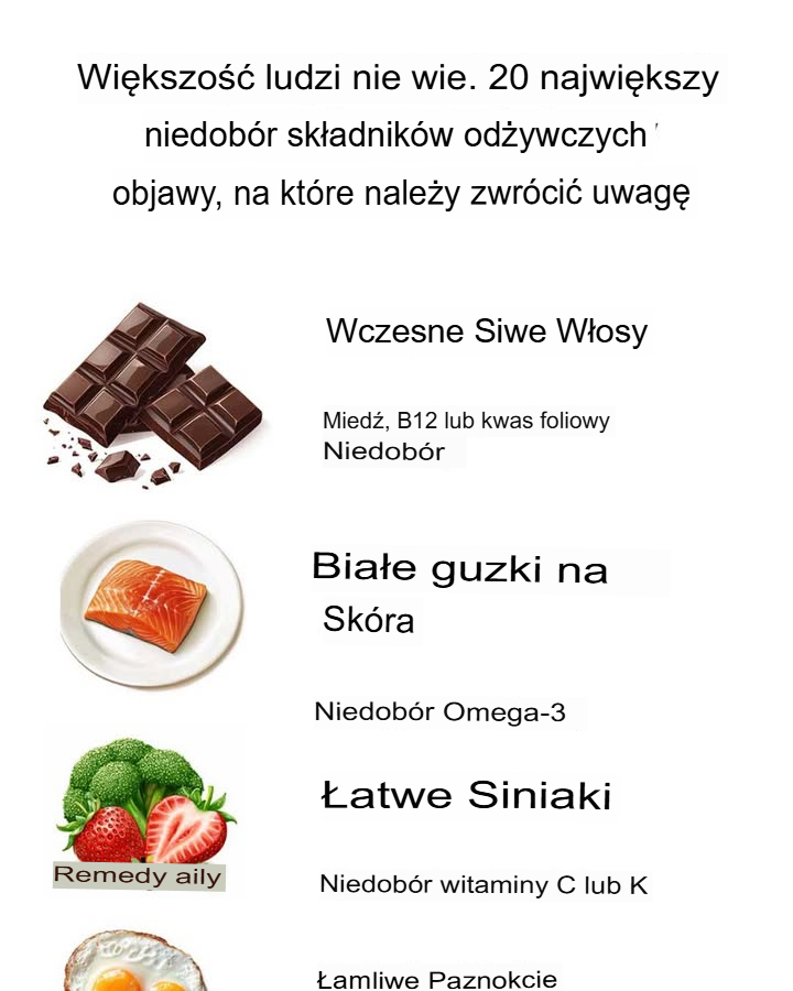20 Najważniejszych Objawów Niedoborów Składników Odżywczych, Które Warto Zauważyć