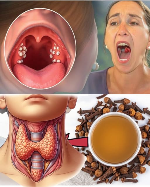 Naturalny Antybiotyk na Ból Gardła