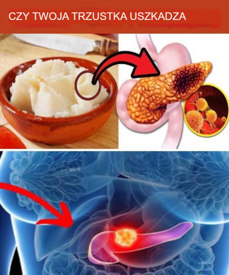 10 najniebezpieczniejszych produktów spożywczych dla trzustki (ryzyko raka trzustki)