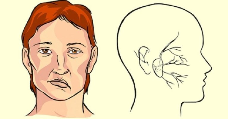 Niekonwencjonalna, ale bardzo skuteczna metoda ratowania przed udarem mózgu