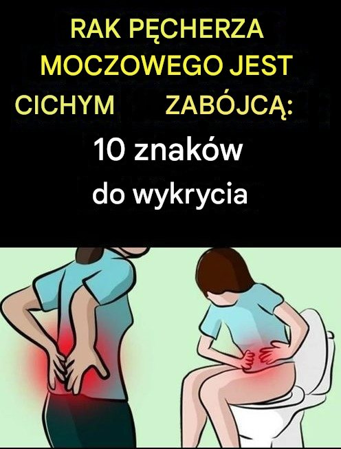 Rak pęcherza moczowego: cichy zabójca – 10 oznak, na które należy zwrócić uwagę