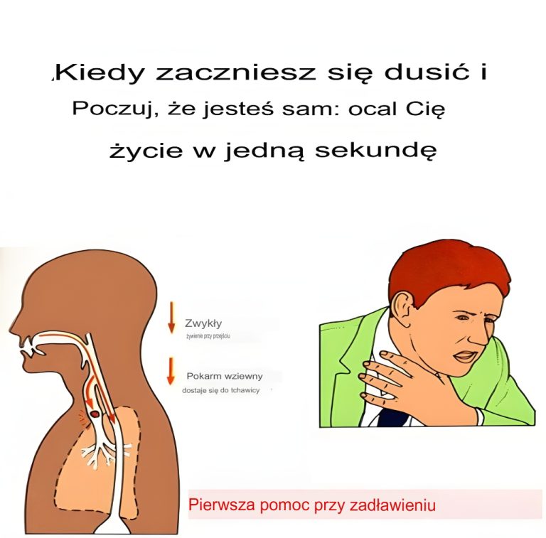 Jeśli zaczniesz się dusić i jesteś sam: uratuj sobie życie w ciągu jednej sekundy