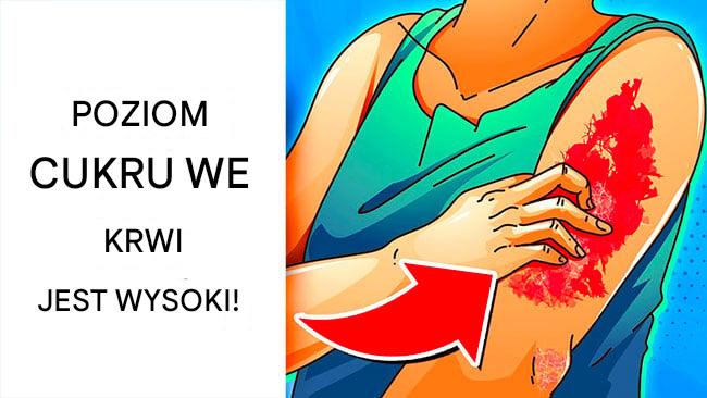 Słodka pułapka: 16 subtelnych objawów zbyt wysokiego poziomu cukru we krwi i 8 sygnałów ostrzegawczych cukrzycy, które łatwo przeoczyć