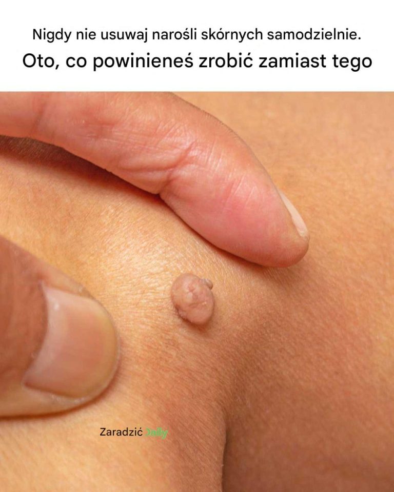 Mój mąż miał zamiar sam to zdjąć! Cieszę się, że to ja to zauważyłam pierwsza!