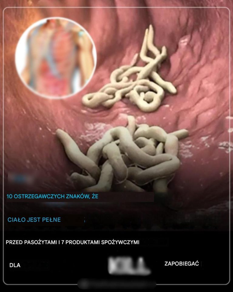 Twoje ciało jest pełne pasożytów
