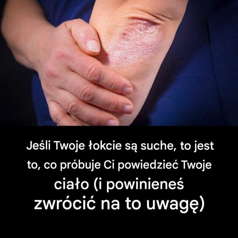Jeśli Twoje łokcie są suche, to jest to sygnał, który próbuje Ci przekazać Twoje ciało