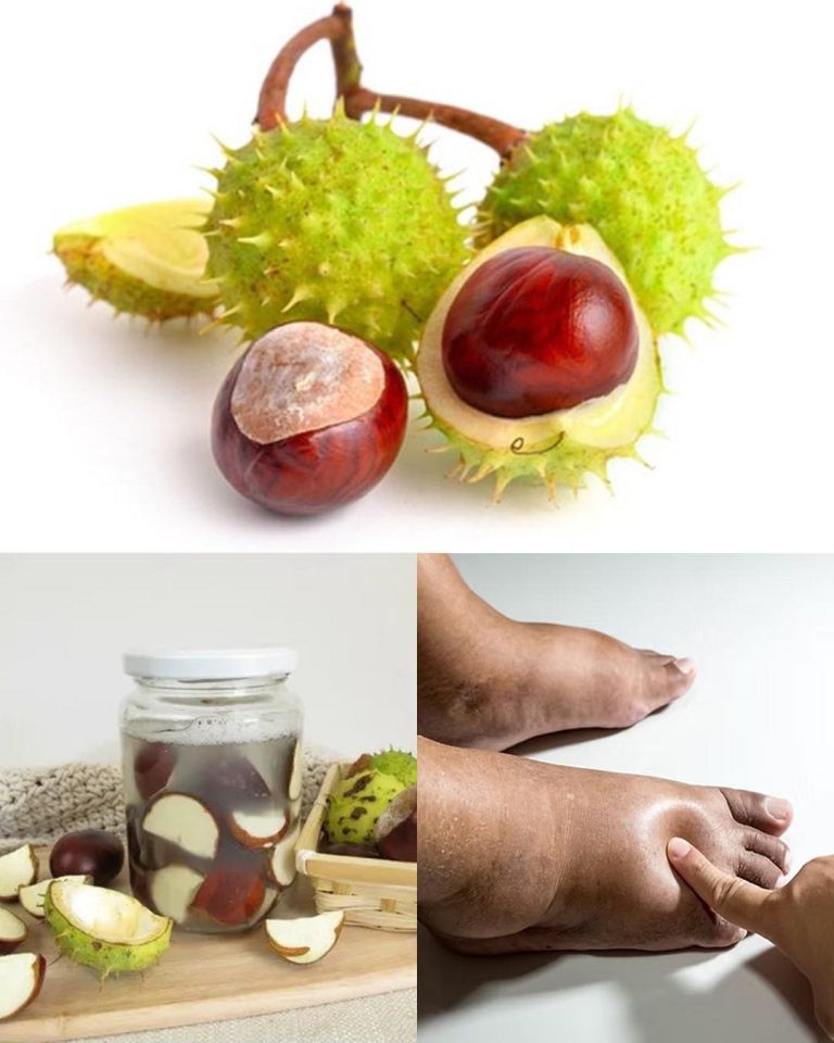 Najskuteczniejszy naturalny środek na opuchnięte nogi i nie tylko