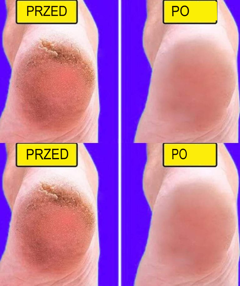 Domowy przepis na miękkie i gładkie stopy w 10 minut