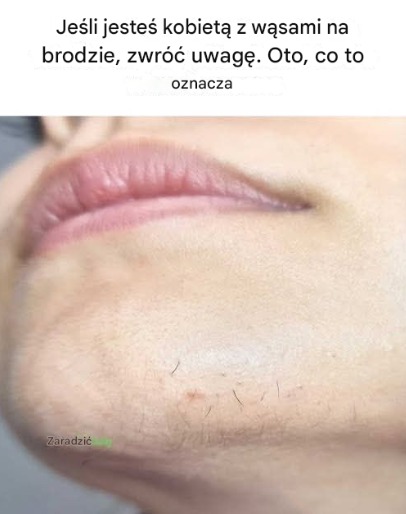 Co wąsy podbródkowe mogą powiedzieć o Twoim zdrowiu?