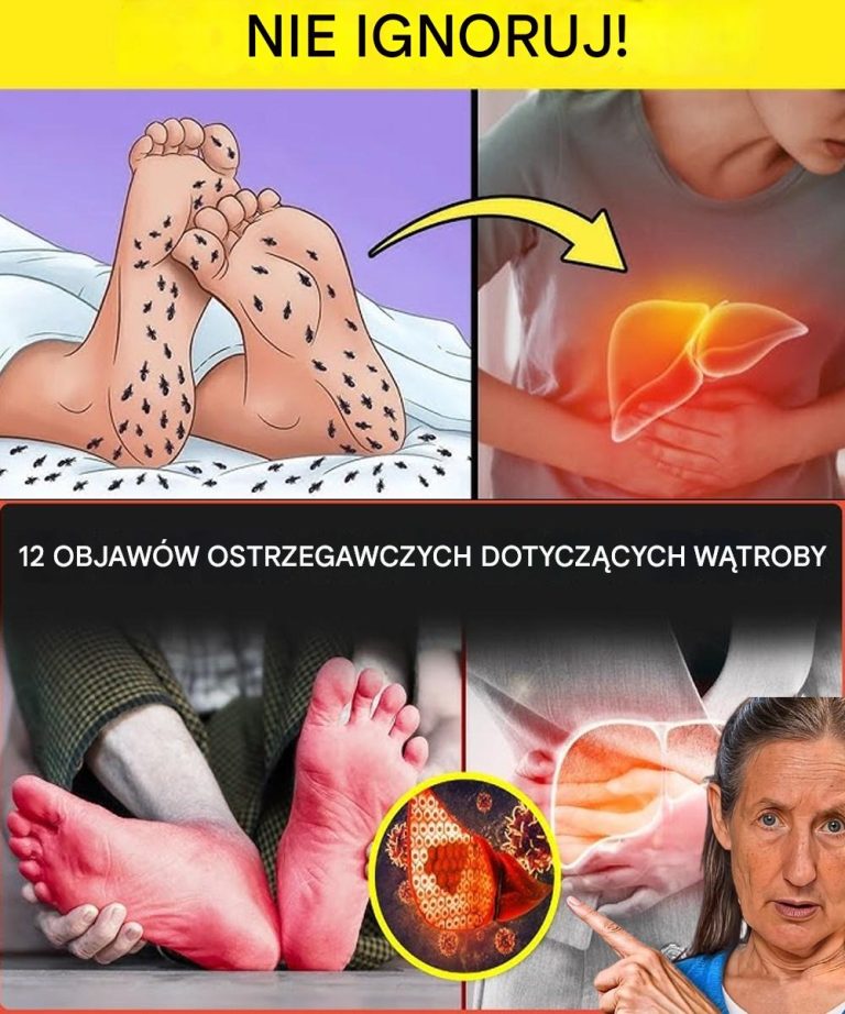 Co Twoje Stopy Mogą Ci Powiedzieć O Twoim Zdrowiu: Na Co Należy Zwracać Uwagę, W Tym Problemy Z Wątrobą