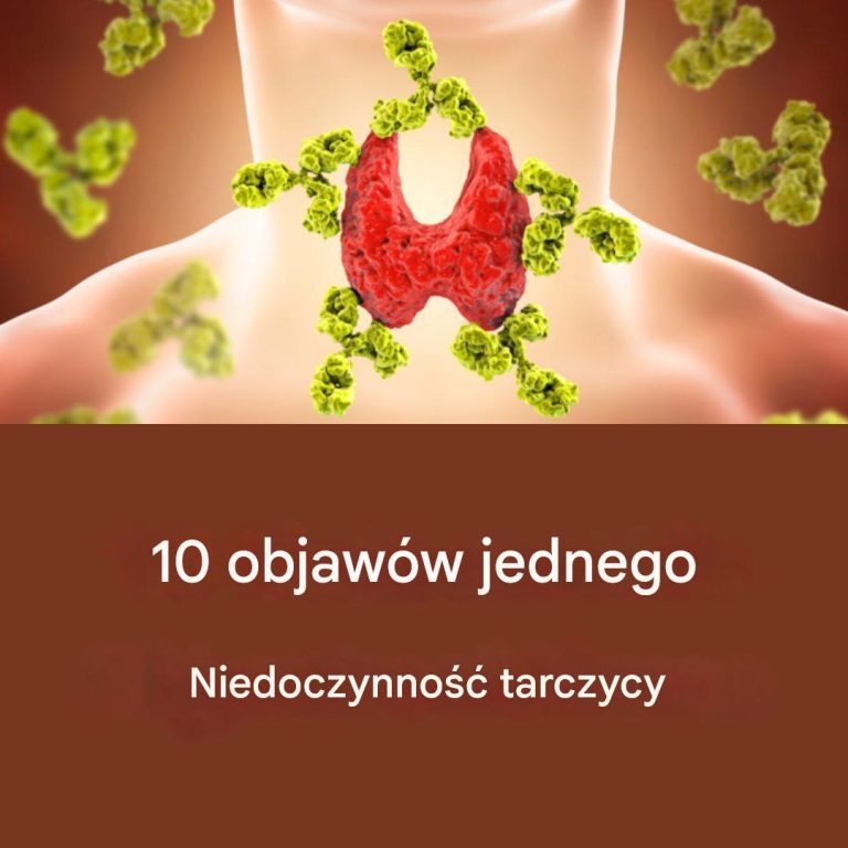 10 objawów niedoczynności tarczycy: rozpoznaj znaki