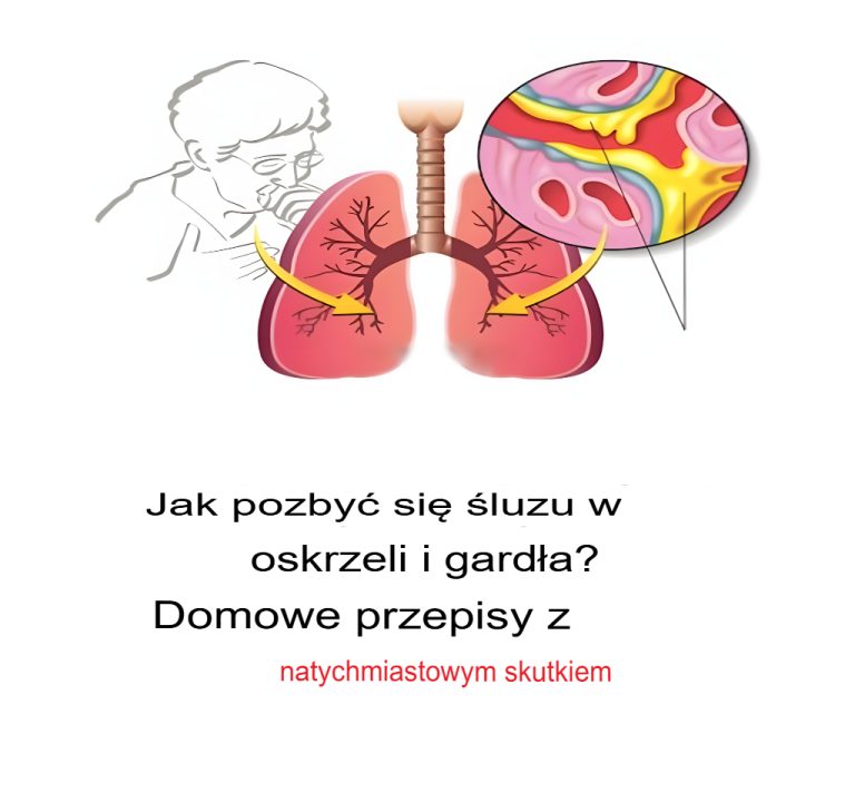 Jak pozbyć się śluzu w oskrzelach i gardle? Domowe przepisy z natychmiastowymi efektami