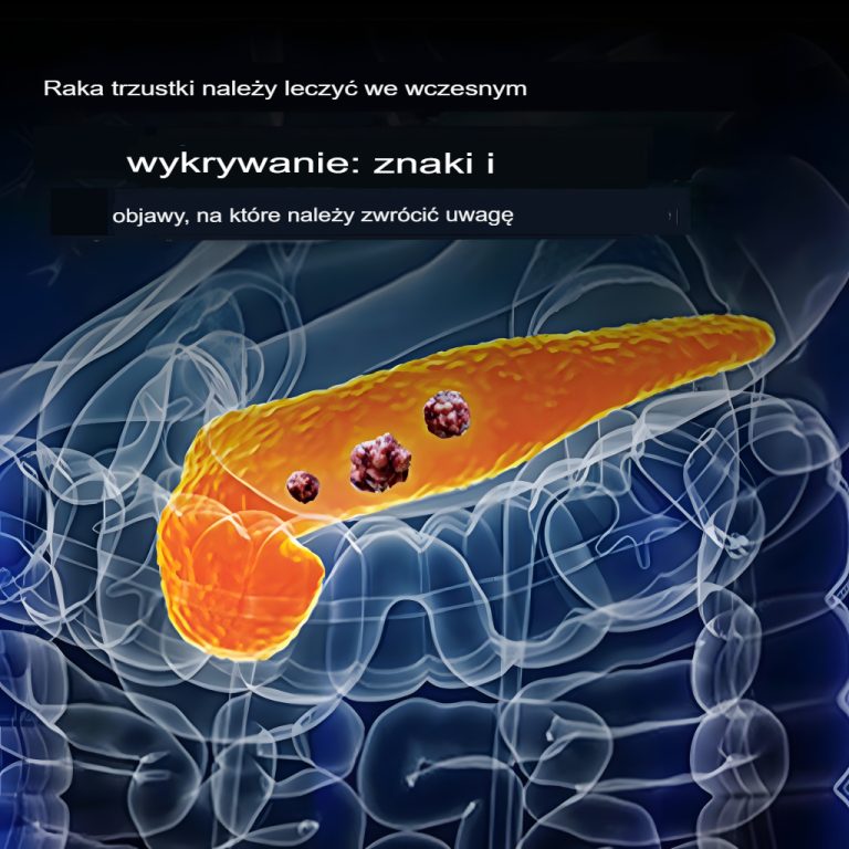 10 oznak raka trzustki, których nie należy ignorować