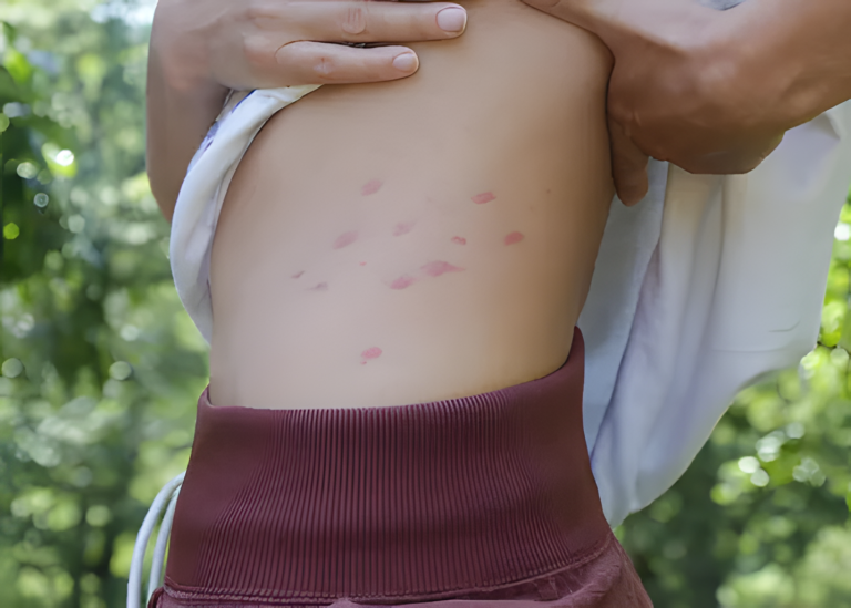 Widoczny objaw chorej trzustki. Objawy stanu zapalnego lub raka.