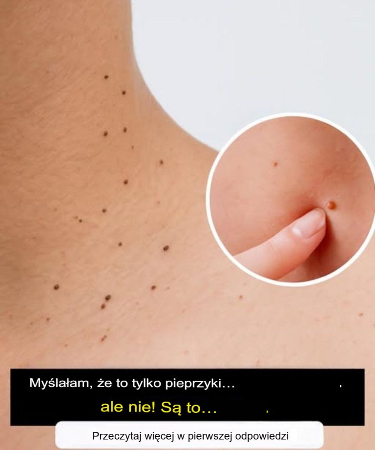 CZYM SĄ WŁÓKNIAKOBRODAWKI I DLACZEGO POJAWIAJĄ SIĘ NA SKÓRZE?