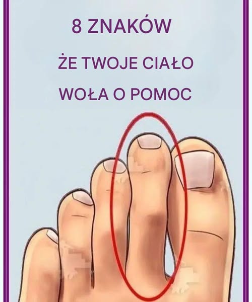 8 oznak, że twoje ciało woła o pomoc