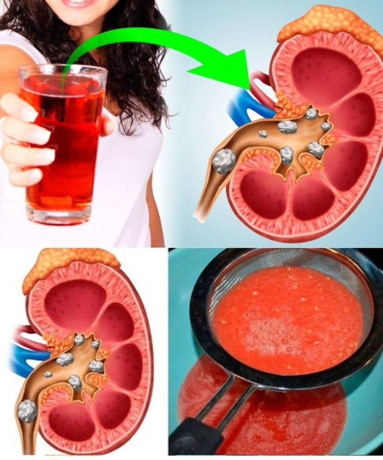 Jak naturalnie oczyścić i odtruć nerki za pomocą soku pomidorowego