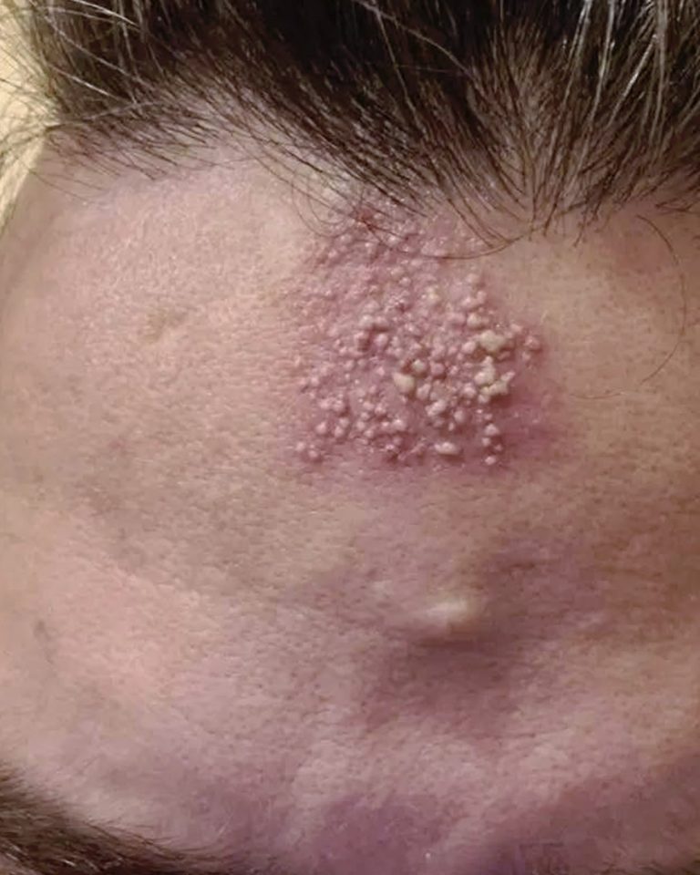 Eksperci twierdzą, że należy porzucić ten zły nawyk