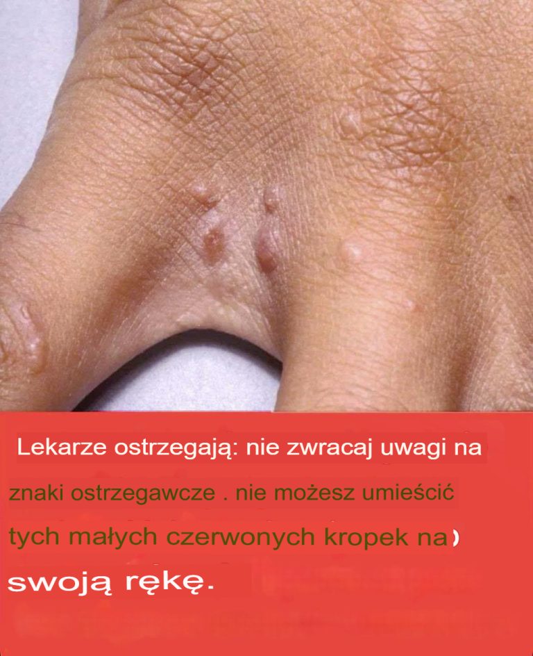 Nie ignoruj tych małych czerwonych plamek na ramieniu: mogą to być poważne sygnały ostrzegawcze.