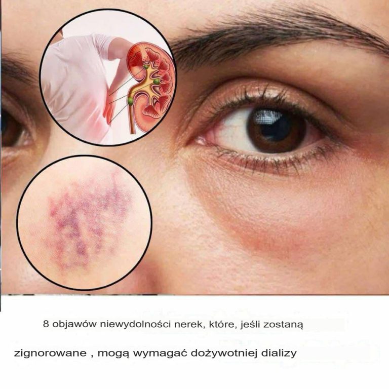 Jeśli Twoje nerki są w niebezpieczeństwie, organizm da Ci znać tymi 10 znakami