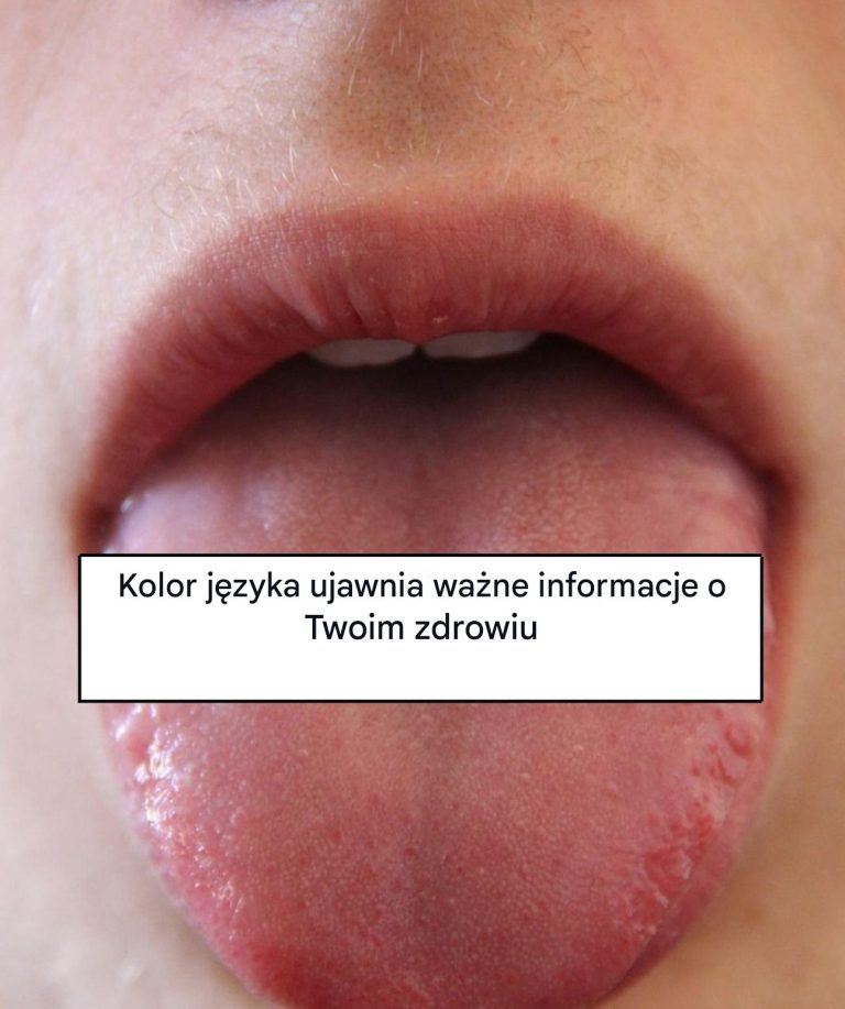 Oto, co Twój język może powiedzieć o Twoim zdrowiu
