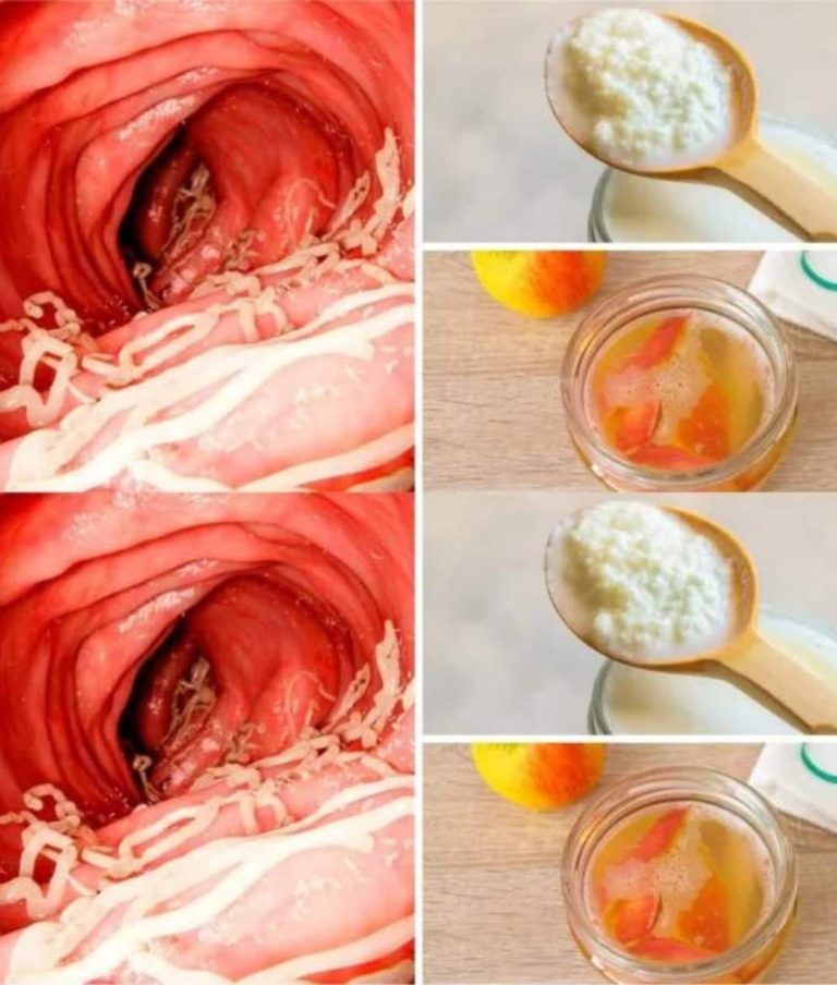 Wygrana w walce z robakami jelitowymi: 5 naturalnych produktów spożywczych na ratunek