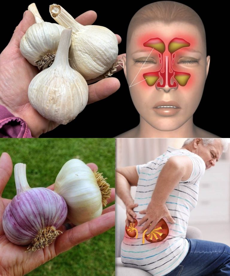 Siła czosnku: naturalny środek wzmacniający odporność