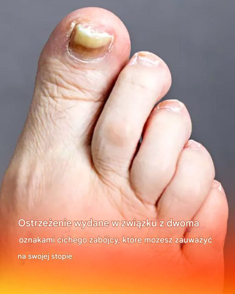 3 subtelne znaki na stopach, które mogą sygnalizować obecność cichego zabójcy