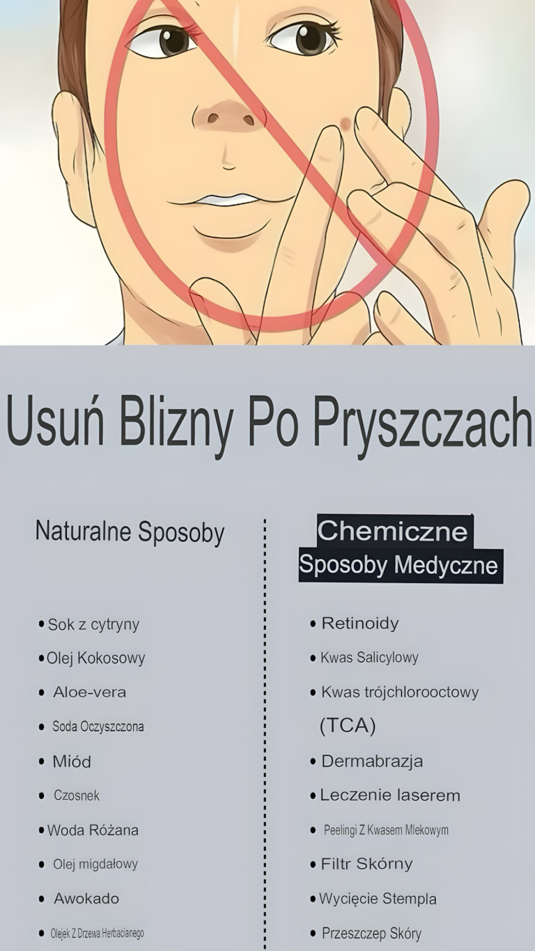 Jak usunąć bliznę po pryszczu