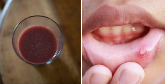 Sok oczyszczający jamę ustną i eliminujący afty: stosuj go jako płyn do płukania jamy ustnej