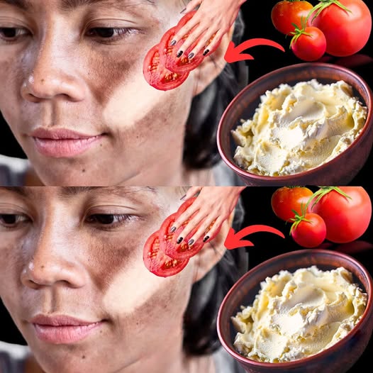 Wyglądaj świeżo i młodo dzięki tej prostej maseczce z pomidorów i skrobi kukurydzianej