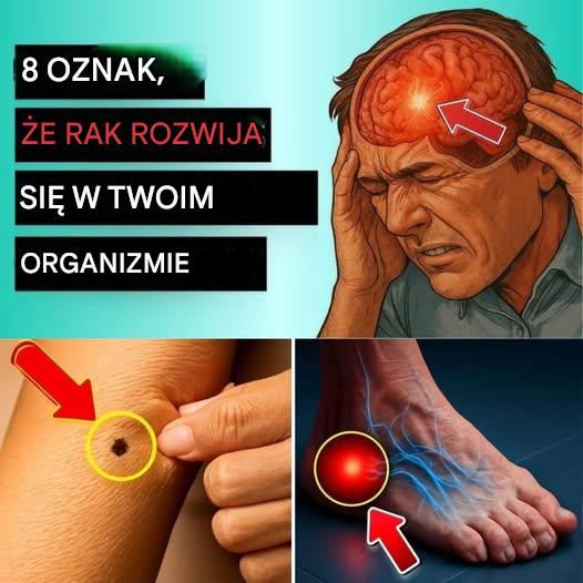 20 wczesnych oznak, że twoje ciało walczy z rakiem