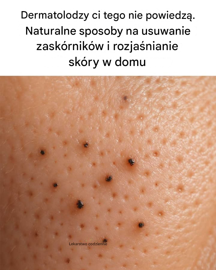Dermatolodzy ci tego nie powiedzą