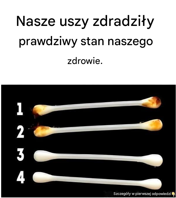 Nasze uszy zdradzają prawdziwy stan naszego zdrowia.