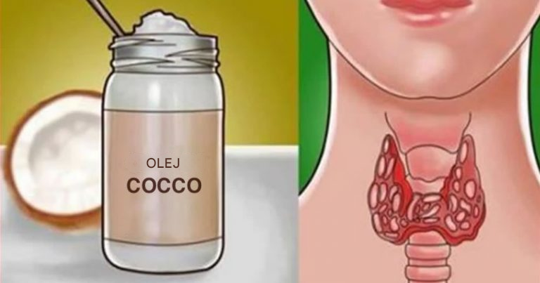 8 niesamowitych korzyści zdrowotnych oleju kokosowego