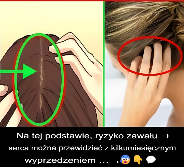 Na tej podstawie ryzyko zawału serca można przewidzieć z kilkumiesięcznym wyprzedzeniem…😰👇💬