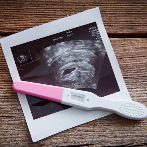 Pierwsze objawy ciąży: na co zwrócić uwagę?