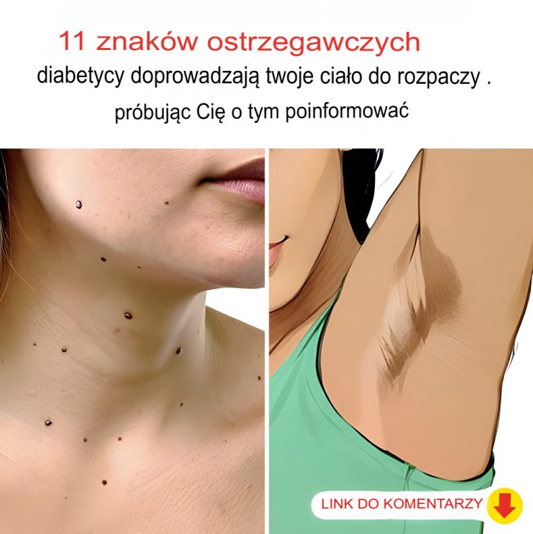11 naprawdę dziwnych objawów cukrzycy