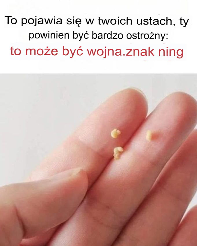 To, co widzisz w ustach, powinno być bardzo ostrożne, może to być sygnał ostrzegawczy