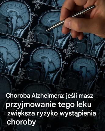 Choroba Alzheimera: zidentyfikowano 6 potencjalnych przyczyn i sposoby na ograniczenie ich wpływu