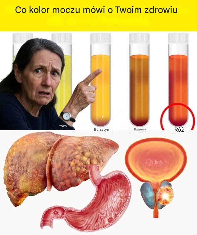 Co mocz mówi o Twoim zdrowiu: oznaki, których nie należy ignorować