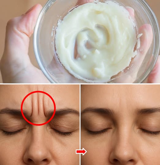 2 maski do usuwania drobnych zmarszczek między brwiami