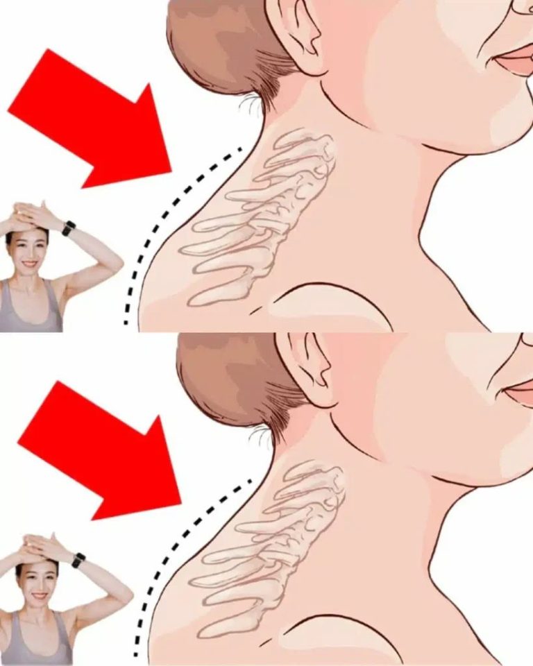 3 ruchy polecane przez specjalistę, które pomogą Ci wyeliminować deformacje kręgosłupa i wyprostować sylwetkę